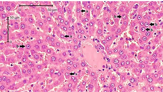 Gambar  15.  Gambar  histologi  hepar  Rattus  norvegicus  yang  dipaparkan  oleh  karbon aktif dalam 8 jam/hari selama 35 hari (HE, 400x)