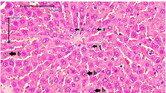 Gambar  17.  Gambar  histologi  hepar  Rattus  norvegicus  yang  dipaparkan  oleh  karbon  aktif  dan  pewangi  ruangan  dalam  8  jam/hari  selama  35  hari  (HE, 400x)