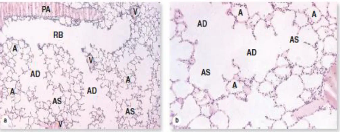 Gambar 2.4 Histologi Bronkiolus respiratorius, ductus alveolus dan alveoli  (Junqueira &amp; Carneiro, 2009) 