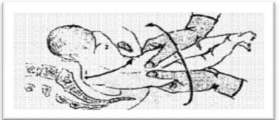 Gambar  2.11  Tubuh  janin  diputar  kembali  180 0  kearah  yang  berlawanan  sehingga  bahu  belakang kembali  menjadi  bahu depan dibawah arcus pubis dan dapat dilahirkan