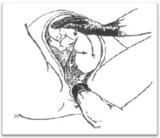 Gambar  2.17  Tangan  dalam  mencari  kaki  dengan  menulusuri bokong sampai fosa poplitea