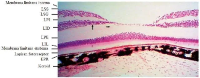 Gambar 4 menujukkan gambaran lapisan retina dan gambaran skematik fovea. LSS adalah lapisan serat saraf, LSG adalah lapisan sel ganglion, LID merupakan lapisan inti dalam, LPE adalah lapisan pleksiformis eksterna, LIL adalah lapisan inti luar, SL adalah se
