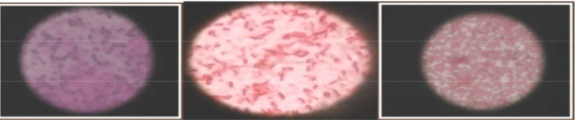 Gambar  1.  Hasil  pengecatan  Gram  bakteri  Staphylococcus  ureus  berwarna  ungu  (A),  Escherichia  coli  (B)  dan  Klebsiella  pneumonia  (C)  berbentuk  batang,  menyebar  dan  berwarna merah
