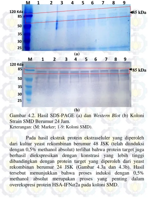 Gambar  4.2.  Hasil  SDS-PAGE  (a)  dan  Western  Blot  (b)  Koloni  Strain SMD Berumur 24 Jam