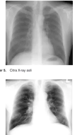 Gambar 6.  Citra X-ray dengan peningkatan kontas
