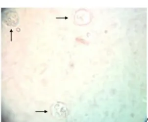 Gambar 3. Takizoit intrasel  (dalam  macrofage) pada exudat peritonial. 