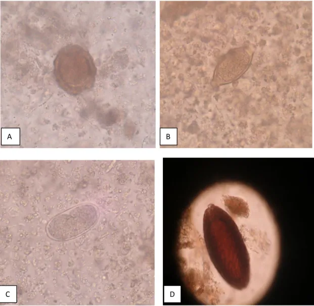 Gambar 1. Identifikasi cacing nematoda saluran pencernaan anak babi di Bali. (A) Telur  cacing Ascarisn sp, (B) Telur cacing Trichuris sp, (C) telur cacing tipe Strongyl dan (D)  Telur cacing Macrachantorynchus hirudinaceus 