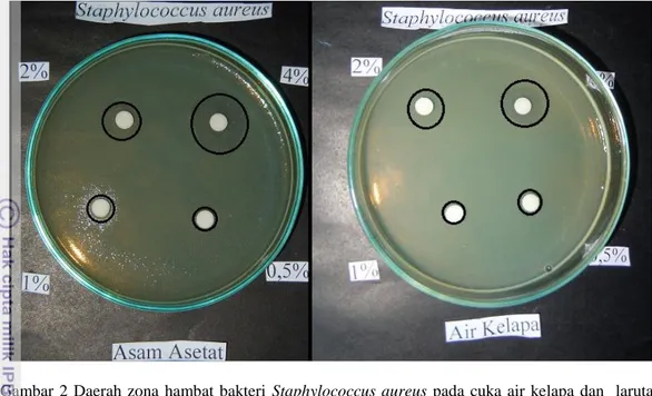Gambar  2  Daerah  zona  hambat  bakteri  Staphylococcus  aureus  pada  cuka  air  kelapa  dan    larutan  asam asetat 
