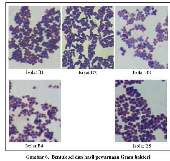 Gambar 6.  Bentuk sel dan hasil pewarnaan Gram bakteri 