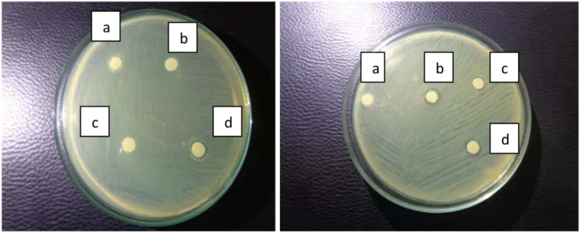Gambar 8. Indikasi Penghambatan bakteri A.hydrophila (a) Enterococcus faecalis 