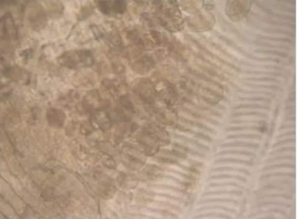 Gambar 3. Vorticella sp (Pembesaran 400X) 