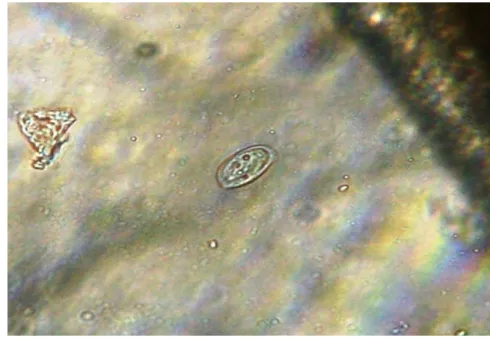 Gambar 3. Chilodonella sp. pada ikan gurame contoh yang dipelihara pada kolam  terpal di Kecamatan Pengasih, Kabupaten Kulon Progo, Yogyakarta  (Perbesaran mikroskop : 40 x 10) 