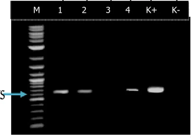 Gambar 3. Ekspresi RNA gen GFP dianalisa dengan menggunakan RT-PCR. 