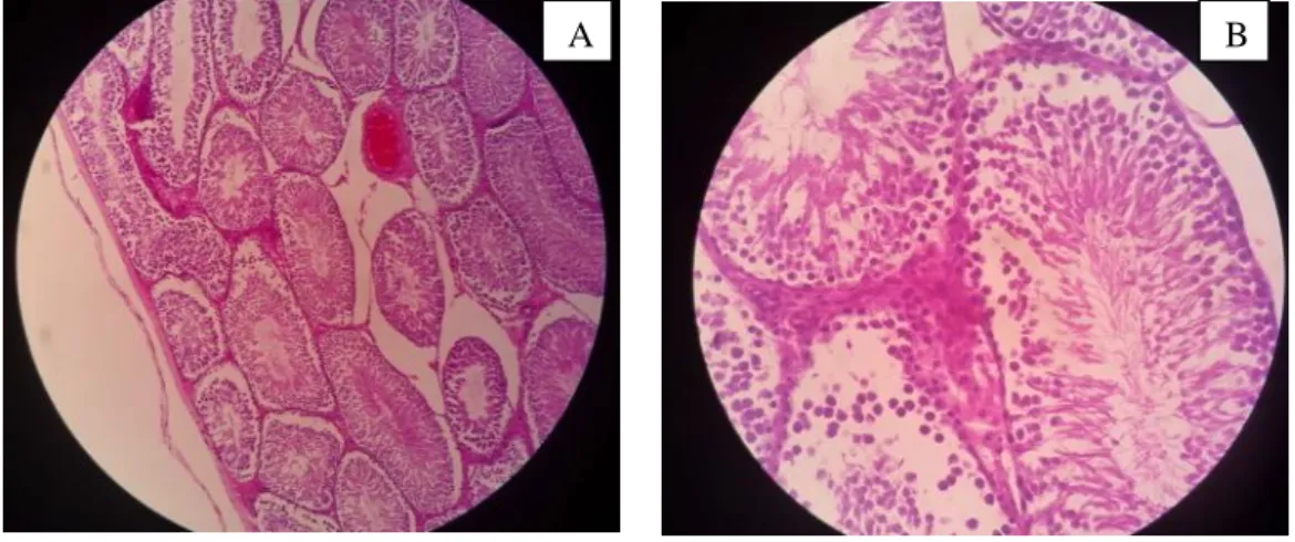 Gambar  di  atas  menunjukkan  perubahan  morfologi  berupa  peningkatan  jumlah  kelompok Sel Leydig pada paparan obat nyamuk bakar