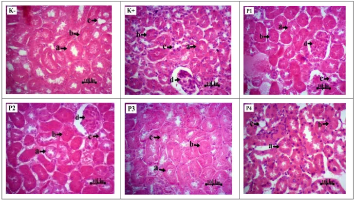 Gambar 1. Gambaran histologis ginjal mencit (Mus musculus L.) perlakuan kontrol (K- dan K+) dan perlakuan (P1,   P2, P3 dan  P4)  Pewarnaan  HE,  perbesaran  400x
