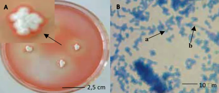 Gambar 1.  (A) Koloni Streptomyces sp. KCM2 usia 5 hari pada media YMA/ISP 4 