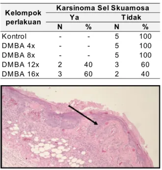Tabel 4. Sebaran karsinoma sel skuamosa menurut kelompok perlakuan N % N % Kontrol - - 5 100 DMBA 4x - - 5 100 DMBA 8x - - 5 100 DMBA 12x 2 40 3 60 DMBA 16x 3 60 2 40Kelompok  perlakuan