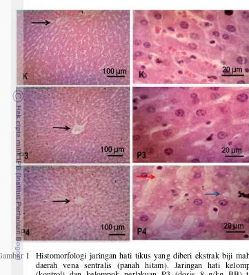 Gambar 1 Histomorfologi jaringan hati tikus yang diberi ekstrak biji mahoni di 