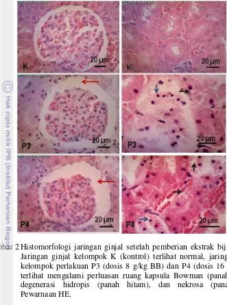 Gambar 2 Histomorfologi jaringan ginjal setelah pemberian ekstrak biji mahoni. 