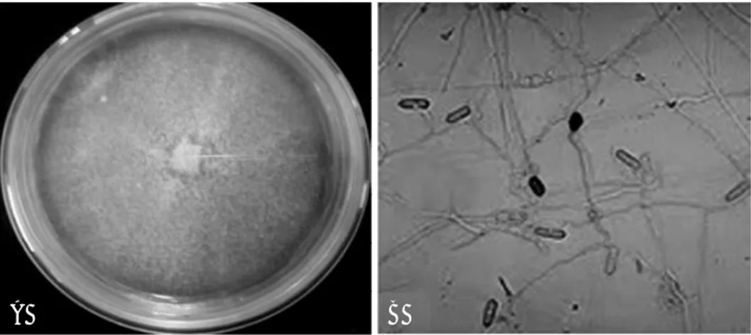 Gambar 1. (A) Koloni Colletotrichum sp. pada media PDA, dan (B) Hifa dan konidia Colletotrichum sp.