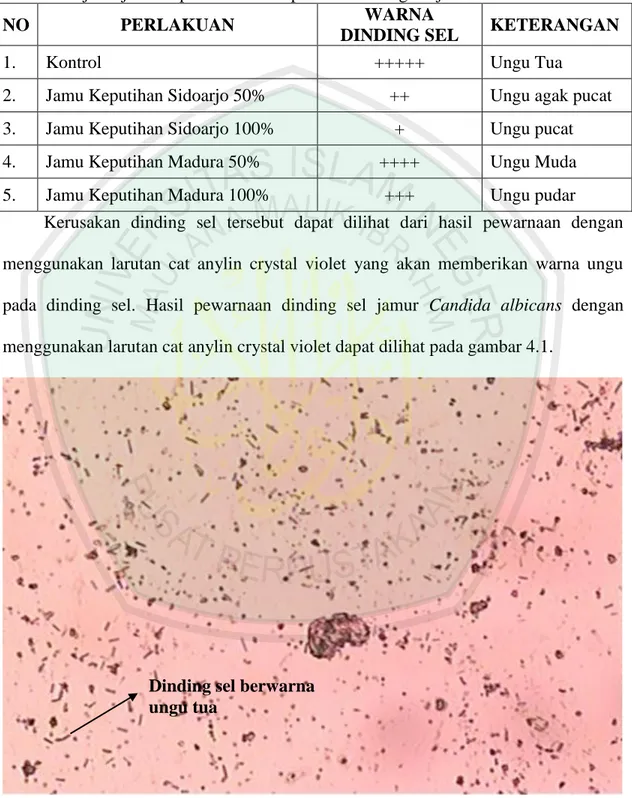 Tabel 4.4:  Hasil pengamatan dengan mikroskop perbesaran 10X10 tentang pengaruh  jenis jamu keputihan terhadap warna dinding sel jamur Candida albicans