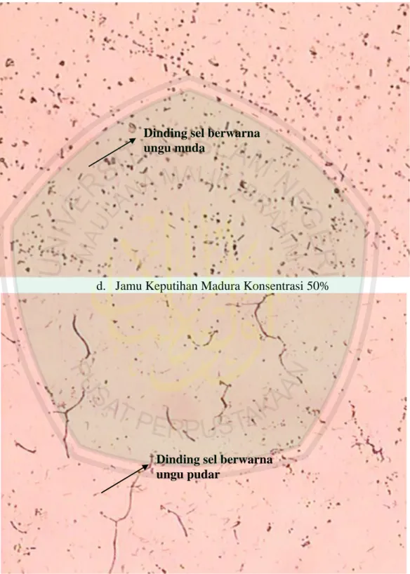 Gambar 4.1.  Pewarnaan dinding sel jamur Candida albicans dengan menggunakan  larutan cat anylin crystal violet