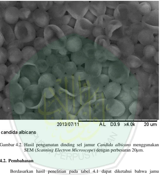 Gambar 4.2.  Hasil  pengamatan  dinding  sel  jamur  Candida  albicans  menggunakan  SEM (Scanning Electron Microscope) dengan perbesaran 20µm