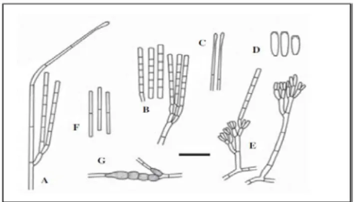 Gambar 2. Cylindrocladium reteaidii. 