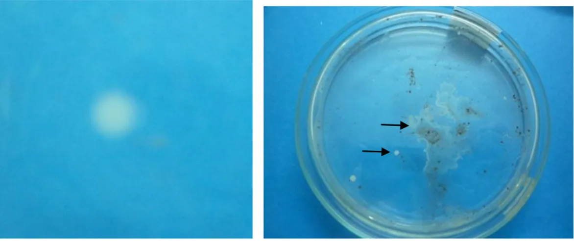 Gambar 2. Morfologi koloni mikroba endofit pada sampel daun sarang  semut; A: isolat BED ; B