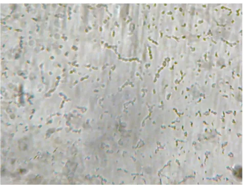 Gambar  8.  Hasil  pengamatan  mikroskopik  morfologi  isolat  KEB  1  pada sampel batang tanaman sarang semut 