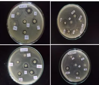 Gambar  2.  Foto  uji  aktivitas  antibakteri  senyawa  derivat  piranon  terhadap  bakteri  uji  E
