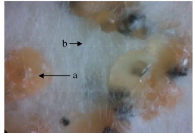 Gambar 3   Tubuh buah C. gloeosporioides di bawah mikroskop :   aservulus (a), seta (b), konidia (c) dan miselium (d)  pada perbesaran 10 x 40 