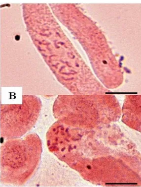 Gambar 6. Kromosom pada P. cujavillus (A) dan P. guajava (B) dengan jumlah 2n=22. Skala garis 5 μm.