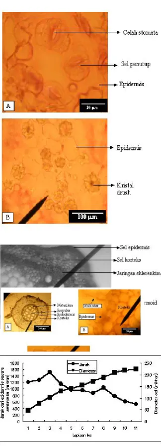 Gambar 6.   Sayatan paradermal daun Dioscorea bulbifera, A) Stomata tipe anomositik; b) Kristal tipe drush