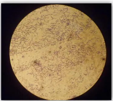Gambar 8. Pewarnaan Gram (+) dari bakteri berbentuk batang (Bacil)  Perbedaan  penyerapan  warna  ini  disebabkan  oleh  perbedaan  senyawa  peptidoglikan  yang  membangun  komplek  dinding  sel  bakteri  dan  permeabilitas  membran  bakteri  Gram  positif