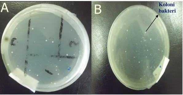 Gambar 4 (a-b). Perbandingan Hasil Isolasi Bakteri Kitinolitik Asal Limbah          Udang dan Kepiting 