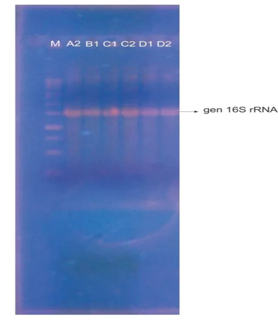 Gambar 8. Elektroforegram PCR Gen 16S rRNA  Keterangan gambar : 