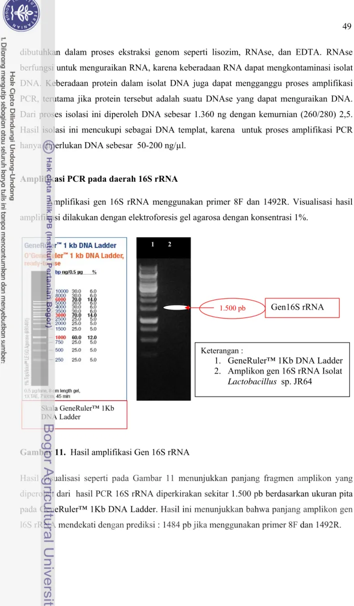 Gambar 11.  Hasil amplifikasi Gen 16S rRNA 