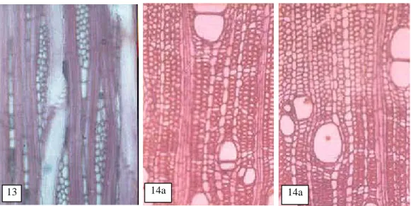 Gambar 12 (Figure 12). Kristal  dalam  sel  jari-jari tegak  S. 