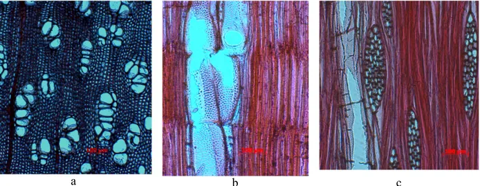 Gambar 10. Struktur mikroskopis kayu  Olearia  sp.  pada (a) penampang melintang (b) radial  dan (c) tangensial