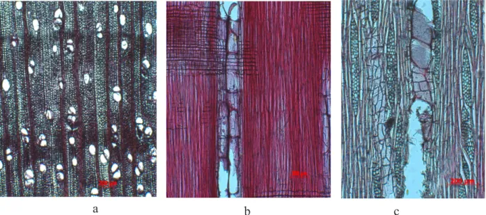 Gambar 4. Struktur  mikroskopis  kayu  Crataeva  membranifolia  pada  (a)  penampang  melintang (b) radial dan (c) tangensial