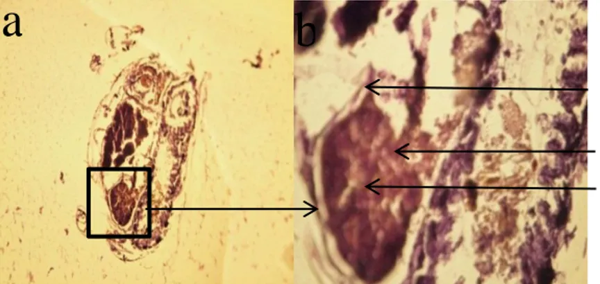Gambar 4 Penampang melintang usus belakang rayap M. gilvus  kasta pekerja (a) perbesaran 100 x, (b) perbesaran 600x 