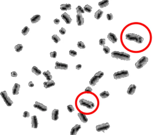 Gambar  8.  Contoh  SCE  (dalam  lingkaran  merah)  yang  tervisualisasikan  pada  G 2  PCC  pada    sel  limfosit  tepi  yang  terpapar  mutagen  kimiawi [15]
