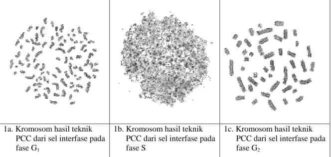 Gambar 1.   Bentuk  kromosom  sebagai  hasil  penggabungan  pada  teknik  PCC  dari  tiga  fase  yang  berbeda (G 1 ,S,S 2 ) [6,7]