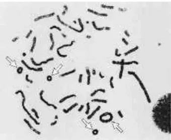 Gambar 4. Kromosom cincin yang terbentuk akibat paparan radiasi pada teknik                       PCC [13]
