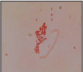 Gambar 2. Hasil pewarnaan Gram Pseudomonas aeruginosa  Bakteri  Pseudomonas 