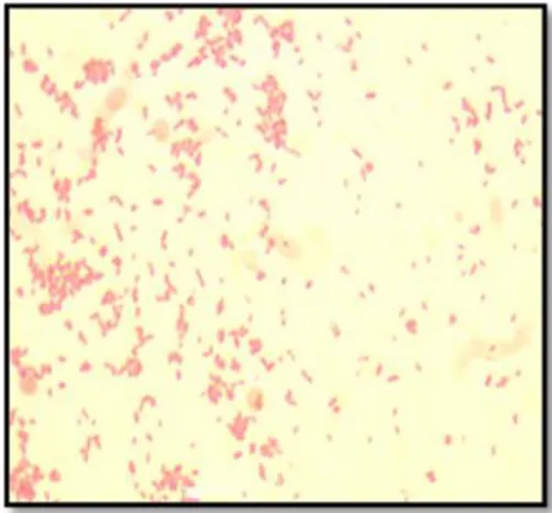 Gambar 3. Hasil pewarnaan Gram Pseodomonas pseudomallei  Hasil  uji  biokimia  bakteri 