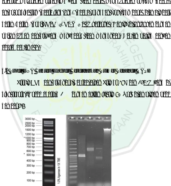 Gambar  4.6  :  Hasil  PCR menunjukkan  sidik  jari  (pita)  DNA  bakteri  endofit  dengan  menggunakan Primer 27F dan 1492R  yang di elektroforesis pada agarose  1%    dengan  aliran  listrik  70  Volt :  Penanda  100  bp  ladder  (kolom  M),  bakteri end