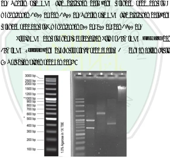 Gambar  4.7  :  Hasil  PCR menunjukkan  sidik  jari  (pita)  DNA  bakteri  endofit  dengan  menggunakan  Primer  umum  gen  16S  rDNA  reverse  dan  16S  rDNA  forward  yang di elektroforesis pada agarose 1%  dengan aliran listrik  70 Volt : Penanda 100 bp