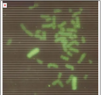 Gambar 3. Contoh hasil pengecatan kromosom  yang mengandung translokasi dengan warna 